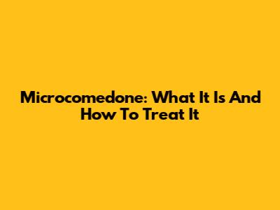 Microcomedone: What It Is And How To Treat It