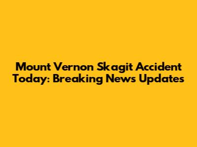 Mount Vernon Skagit Accident Today: Breaking News Updates